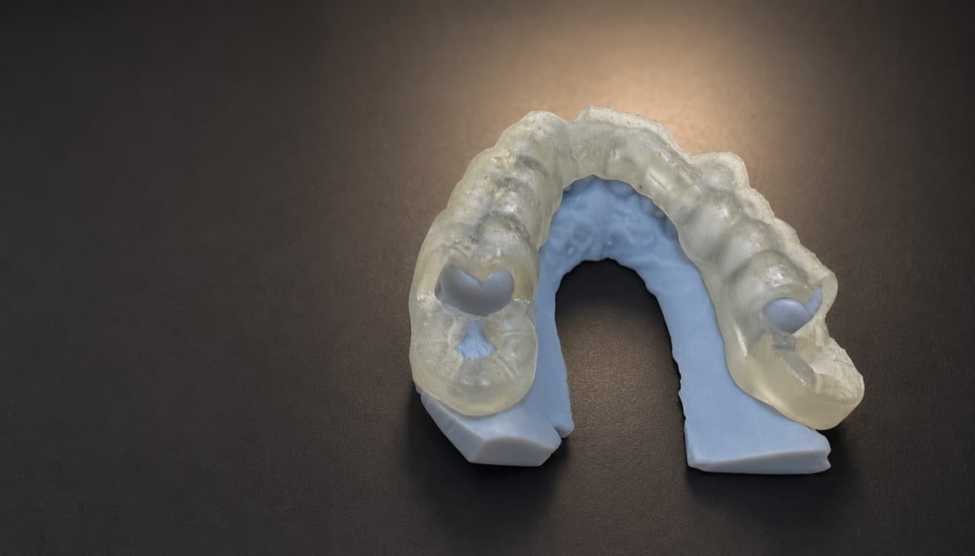 Finished transparent surgical guide seated on a blue 3D-printed dental model.